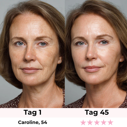 Glamarou LUMISKIN Lift & Glow Gerät