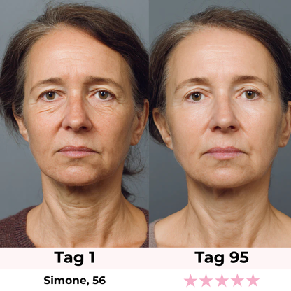 Glamarou LUMISKIN Lift & Glow Gerät