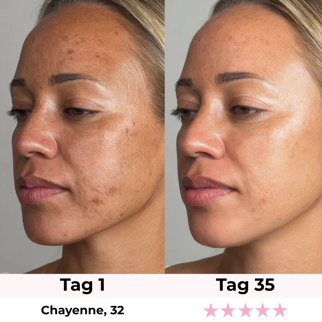 Glamarou LUMISKIN Lift & Glow Gerät