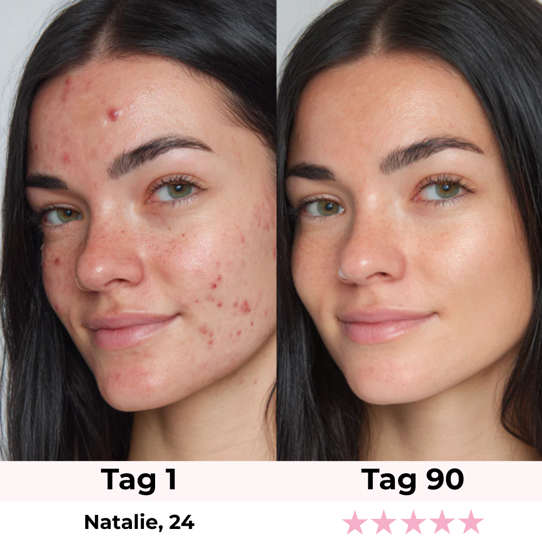 Glamarou LUMISKIN Lift & Glow Gerät