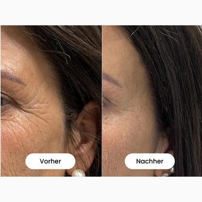 Glamarou LiftSense - Rotlichtmaske