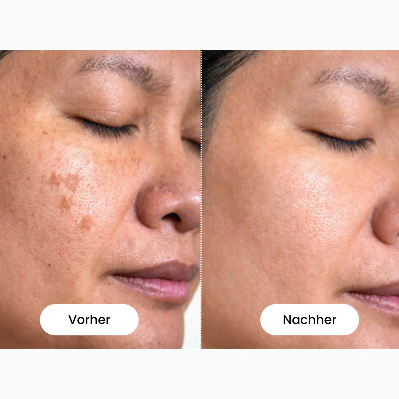 Glamarou LiftSense - Rotlichtmaske