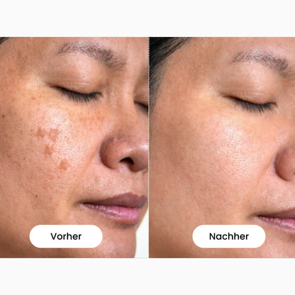 Glamarou LiftSense - Rotlichtmaske